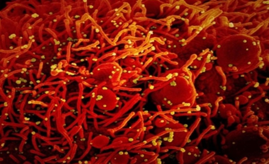 कोरोना मरीजों में साइटोमेगालो वायरस के कारण मल के रास्ते में ब्लीडिंग के सामने आए पांच मामले