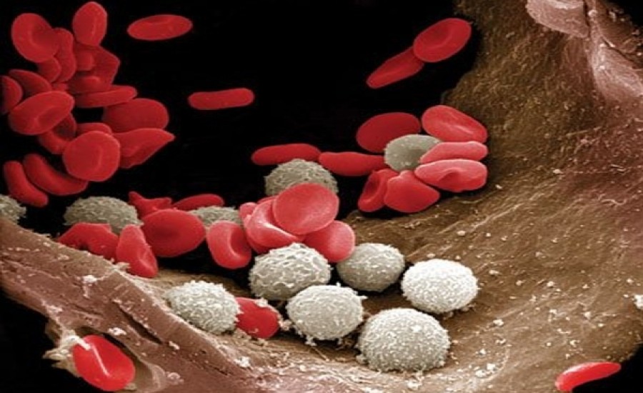 श्वेत रक्त कोशिकाएं कोविड की गंभीरता को कैसे दर्शाती है?